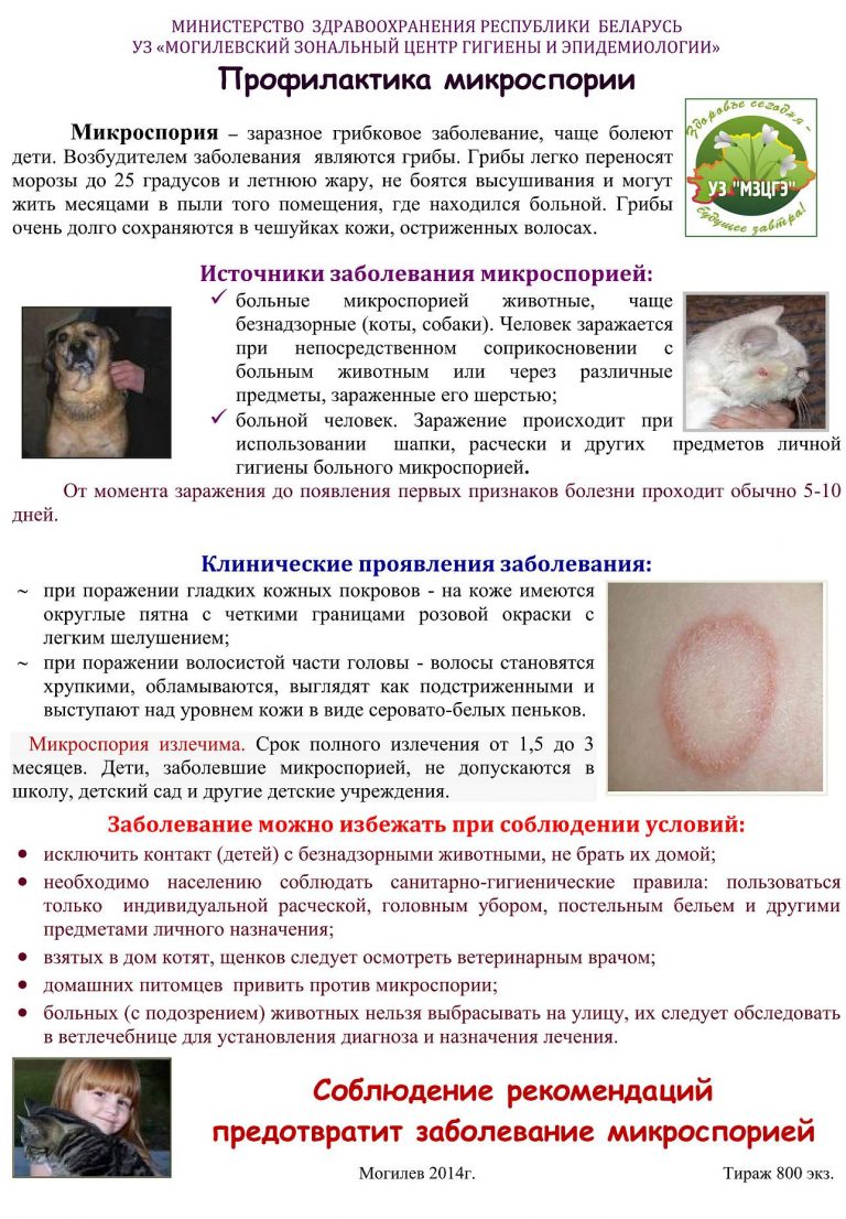 Как выглядит лишай как вылечить Родителям - МБОУ "Школа № 15"